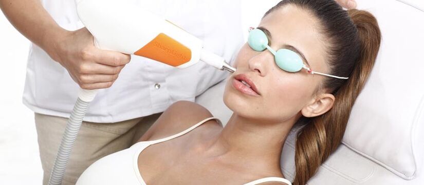 Laserowy resurfacing skóry